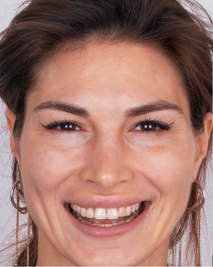 Original sample smile