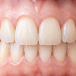 A Dental Office with Less Reviews Can EASILY Rank Higher